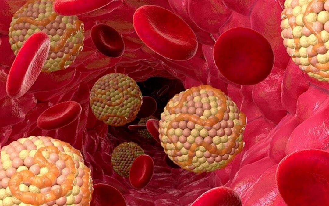 Δυσλιπιδαιμία / Υπερλιπιδαιμία